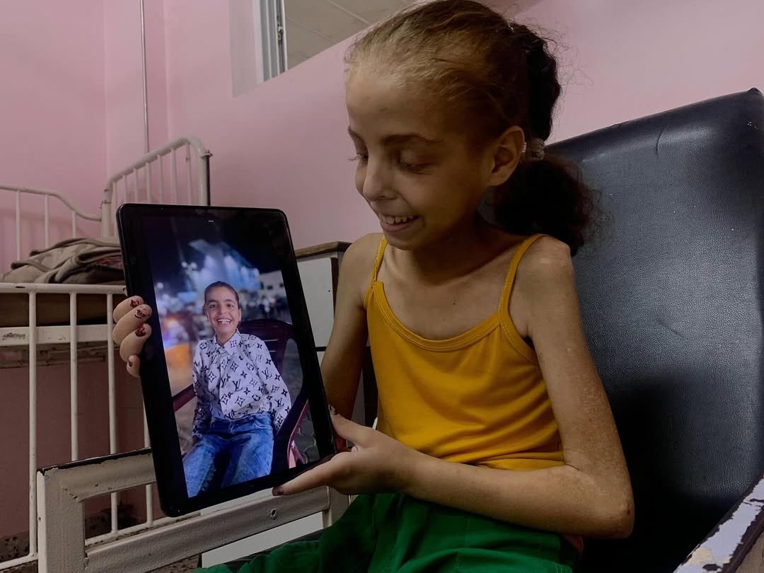 Urgent Appeal: Malnourished Girl With Celiac Disease in Gaza