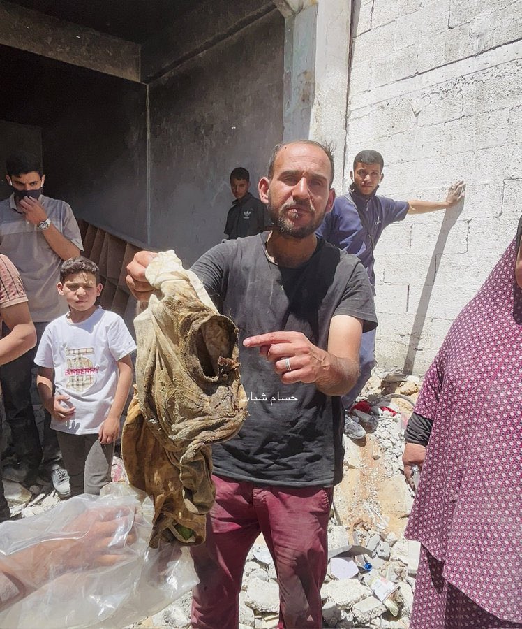 Alleged casualty from Israeli forces in Jabalia