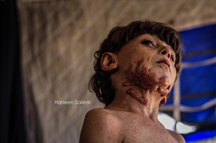 Six-year-old boy traumatized by school bombing in Gaza