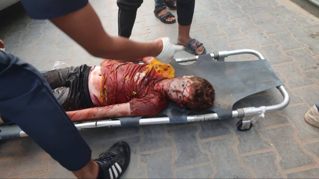 Mother and son injured in Israeli bombing Khan Younis