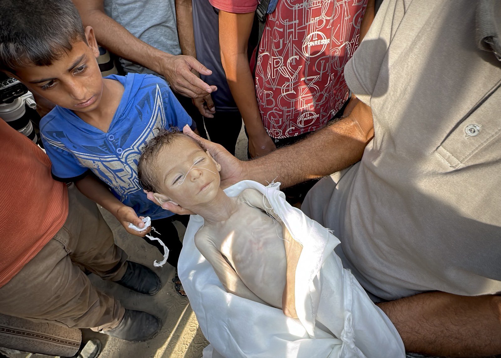 Children dying from dehydration and malnutrition in Gaza