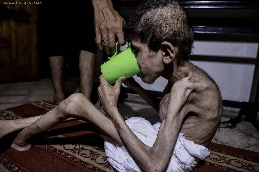 Continued Call for Attention to North Gaza Famine Crisis