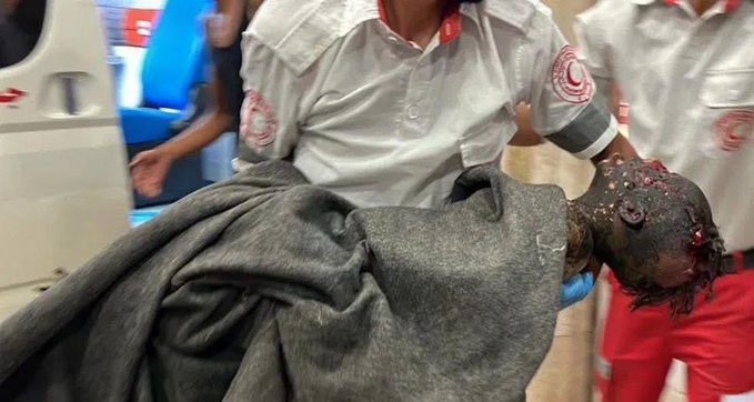 Displaced Persons Killed in Israeli Bombing Al Mawasi