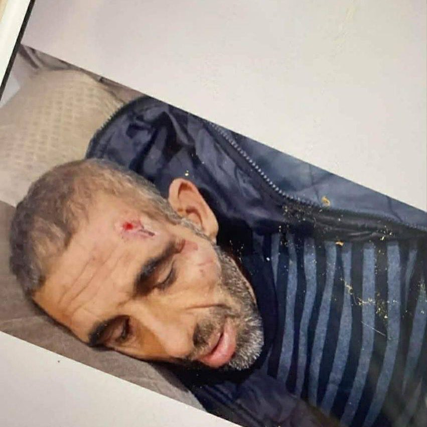 Ministry reports death of 20-year-old in Qabatiya raid