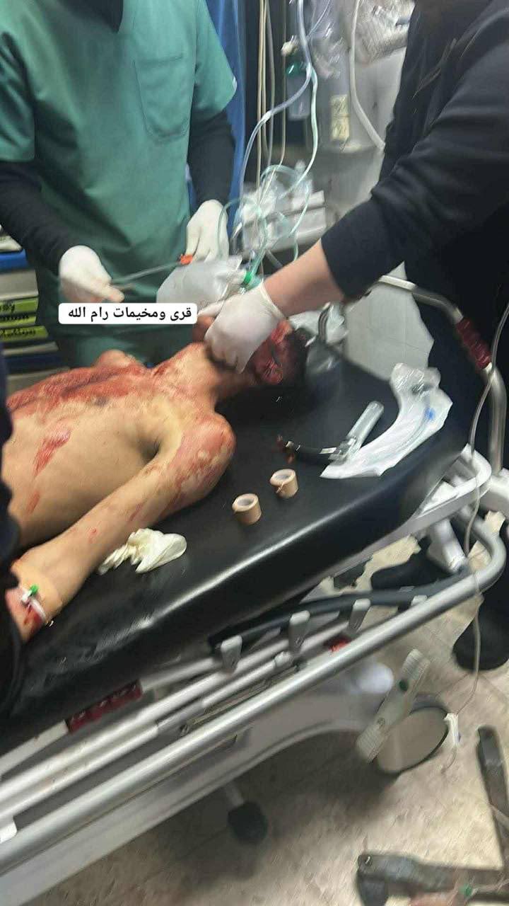 Young Man Shot During Raid in Bani Zaid Village