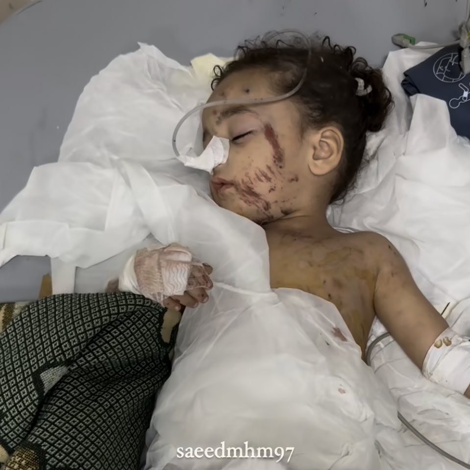 Children Severely Injured, Mother Killed in Israeli Attack
