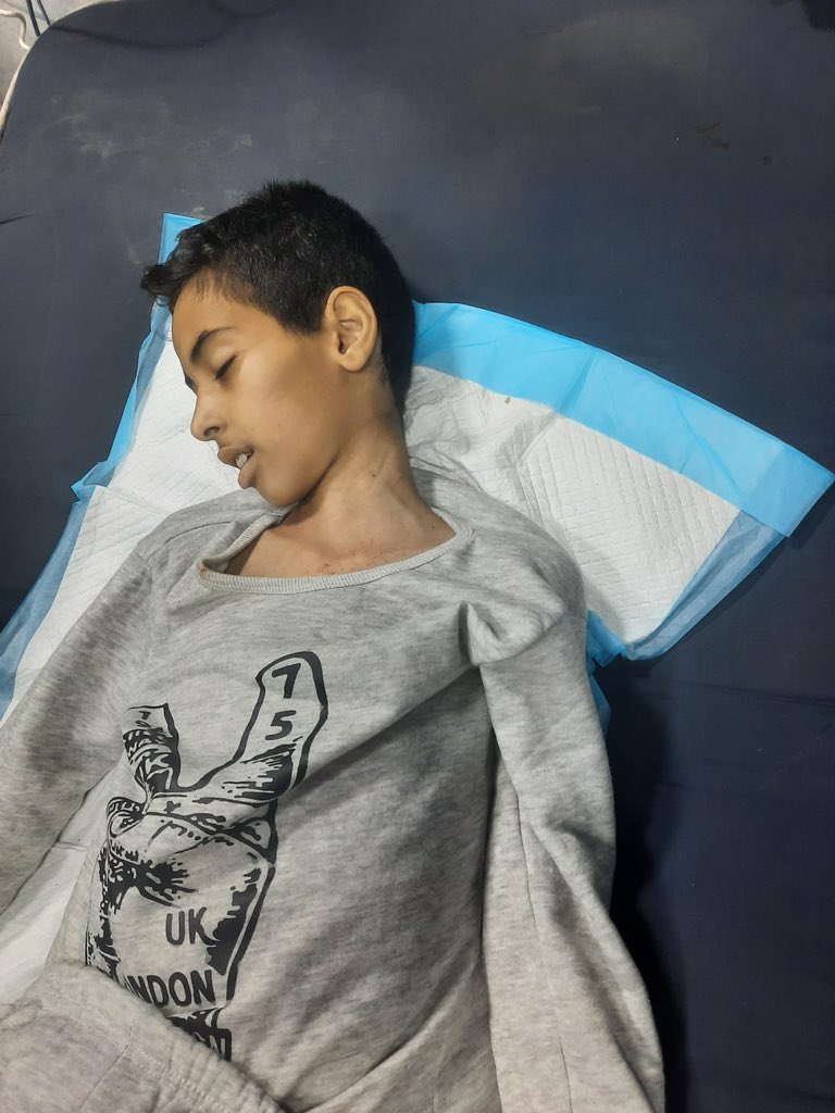 Children Die from Malnutrition and Dehydration in Gaza Hospital