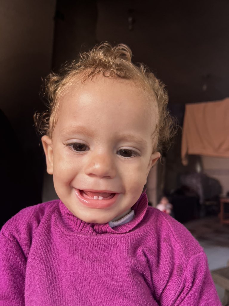 Grandson suffering malnutrition and lack of medicines in conflict zone