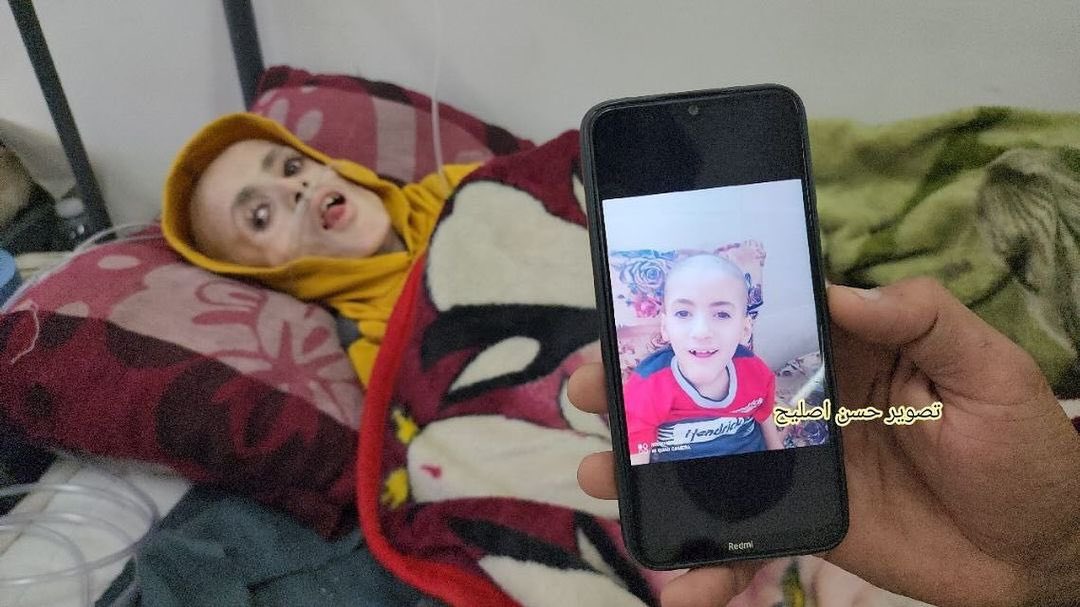 Child dies from malnutrition during Gaza siege