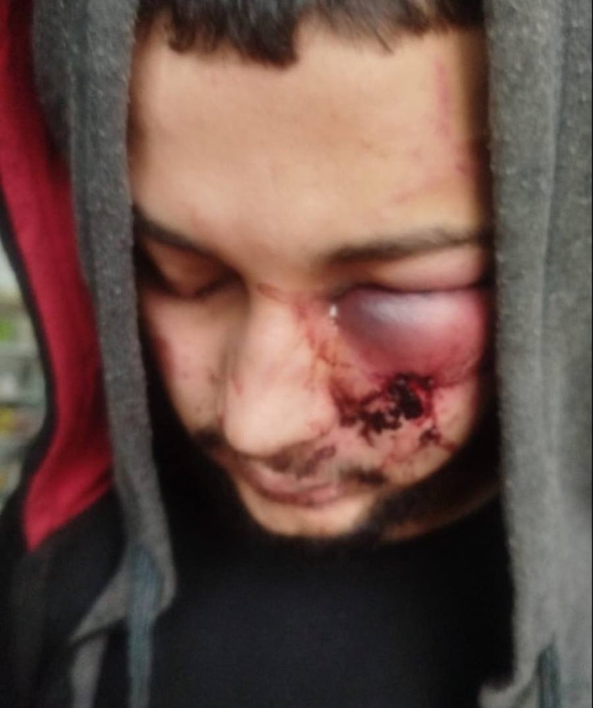 Palestinian detainee allegedly tortured in West Bank
