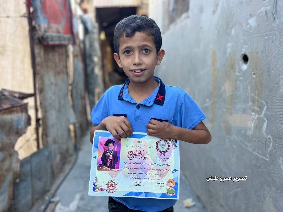 13-Year-Old Boy Loses Fingers in Explosion Accident Gaza