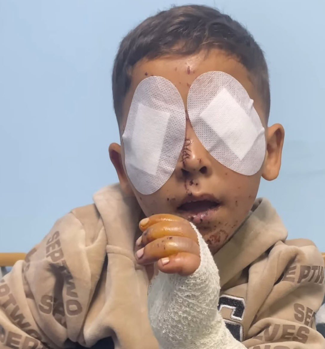 Gaza Eye Hospital Reports 17,000 Injuries From Conflict