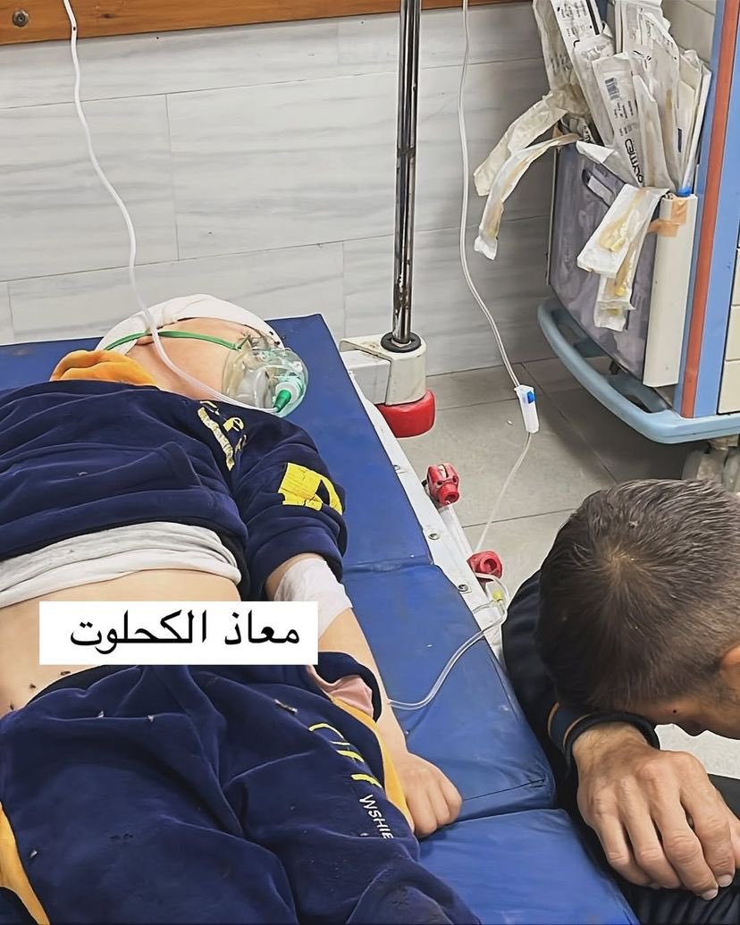 Children Injured in Continuous Bombing of Northern Gaza