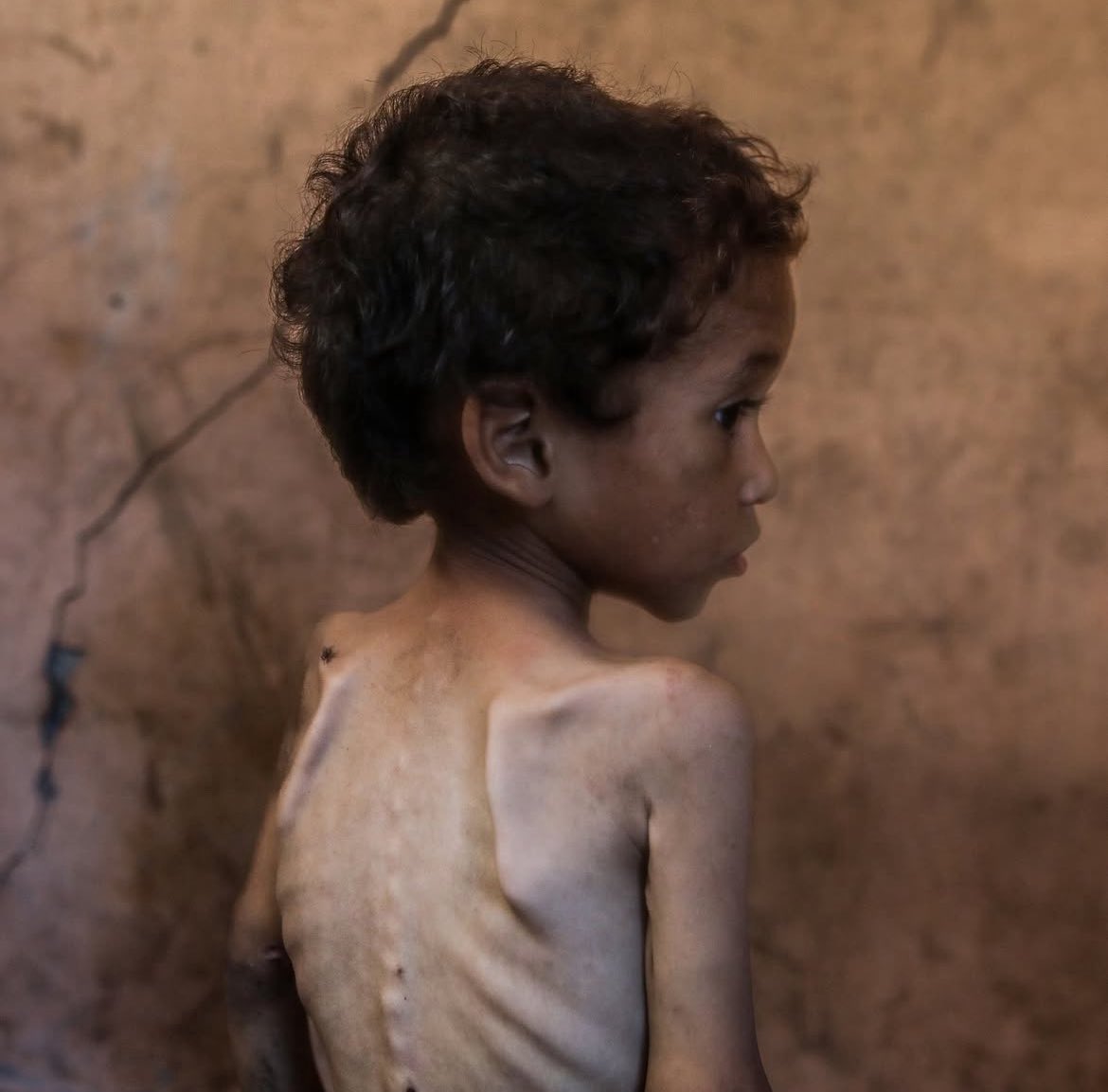 Israeli Forces Fire on Gaza Aid Queue, Starvation Crisis Worsens