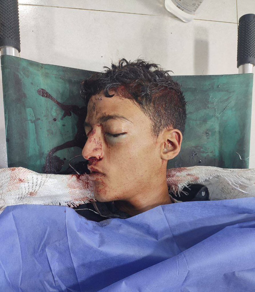 Person killed by Israeli forces awaiting aid