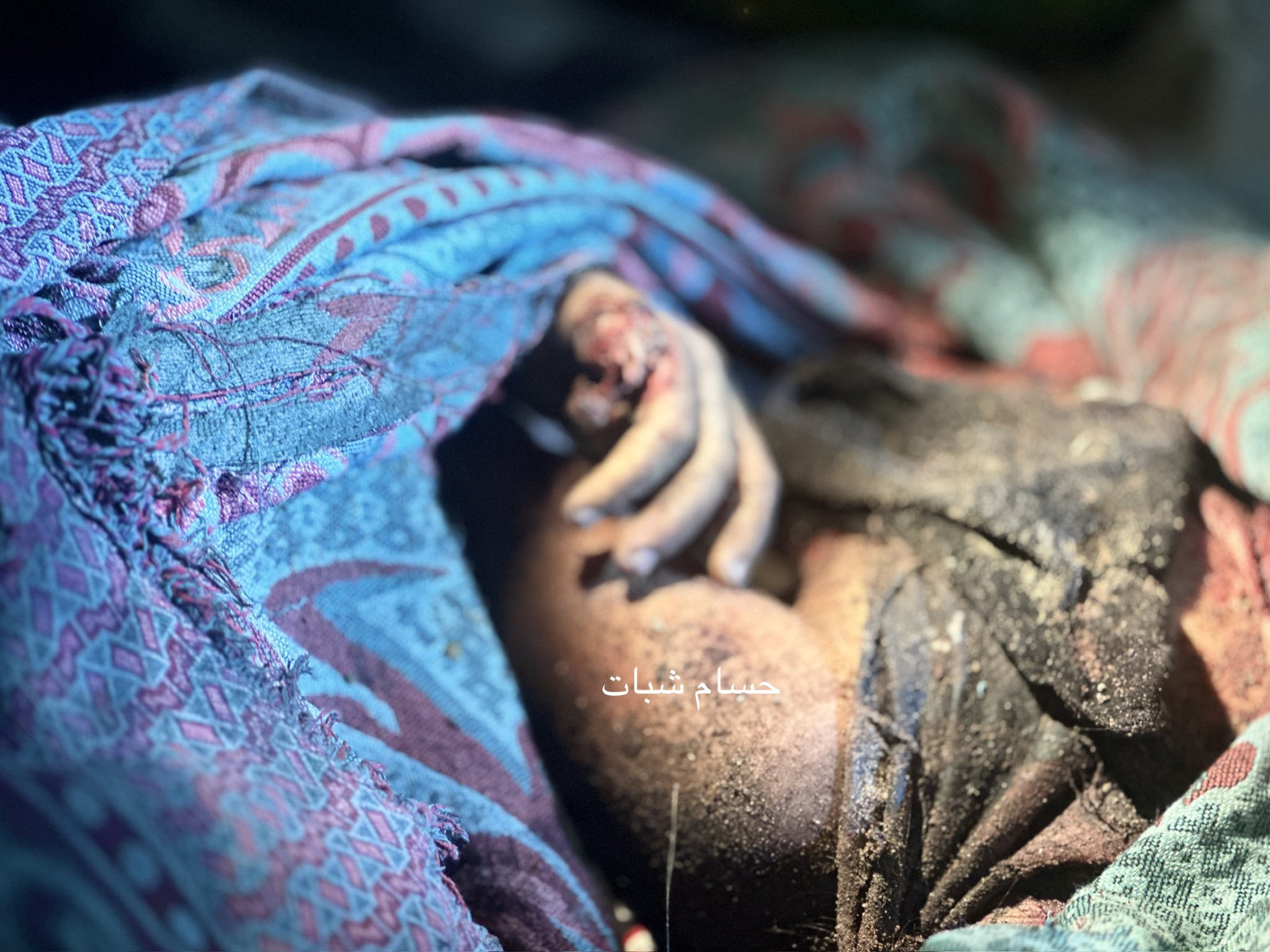 Dismembered hand discovered without body