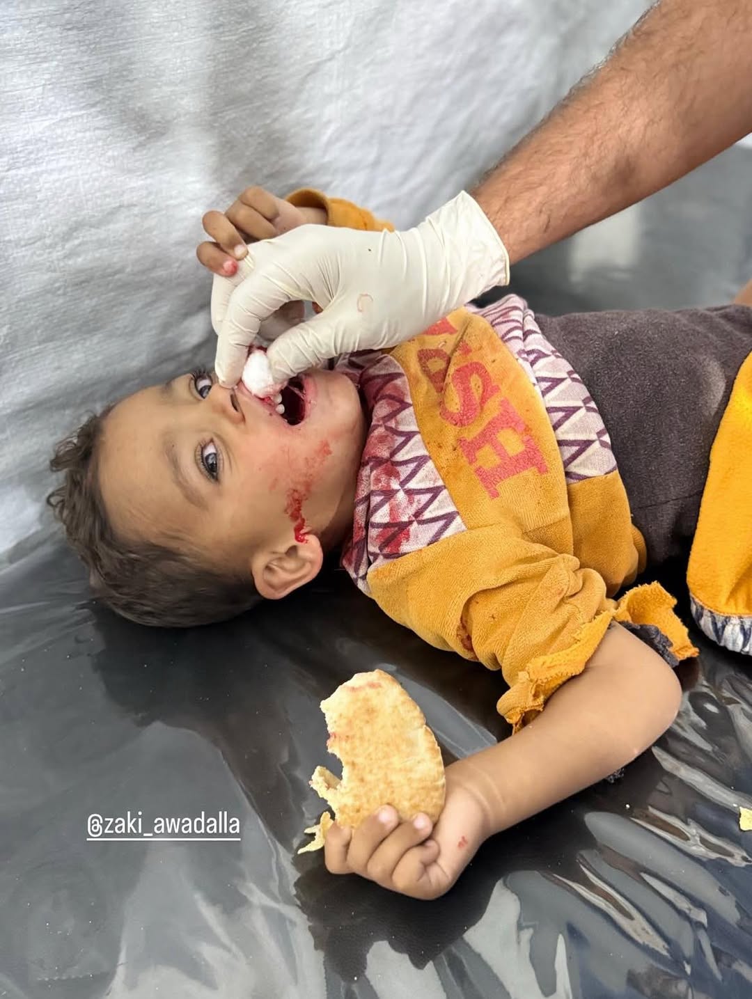 Child Arrives at Hospital After Tent Targeted by Israeli Forces