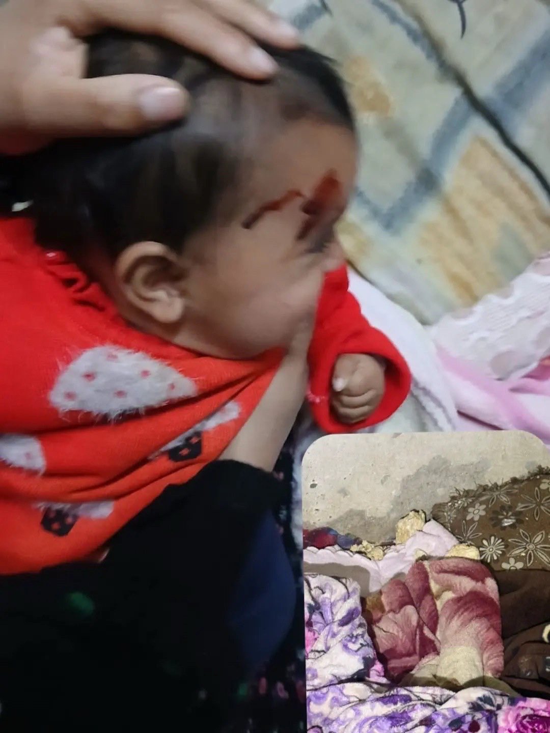 Child injured by settlers in Sa’ir, Hebron