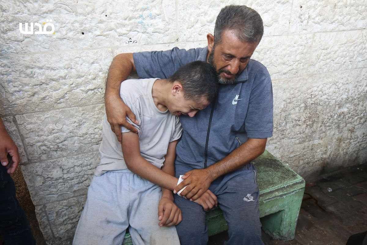 Released Palestinian Prisoners Arrive at Hospital After Months of Torture