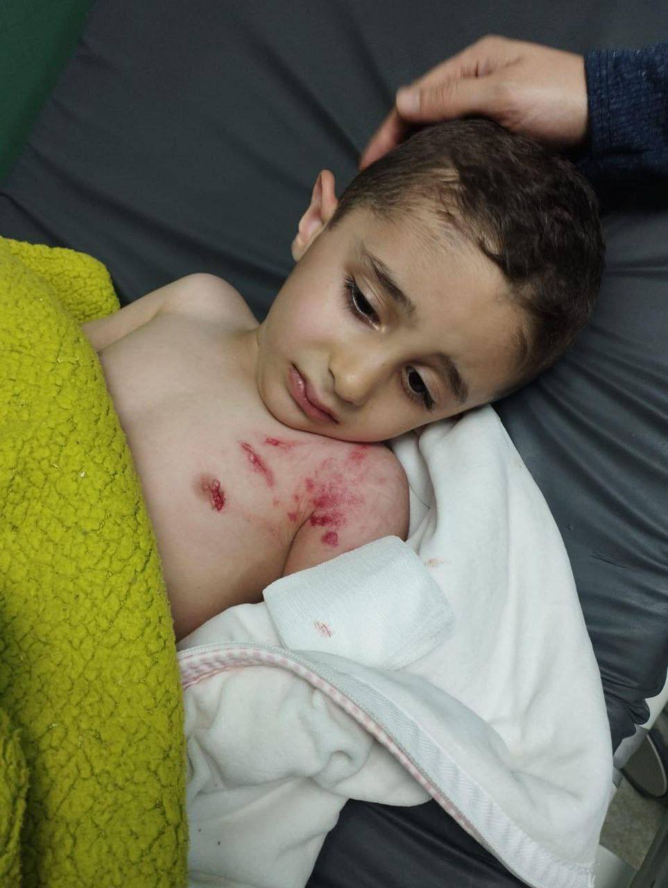 Israeli forces deploy dog against Palestinian child in Qabatya
