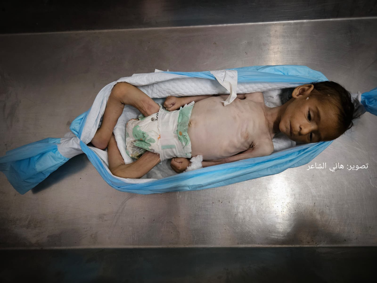 Child death from starvation in blockaded Gaza Strip