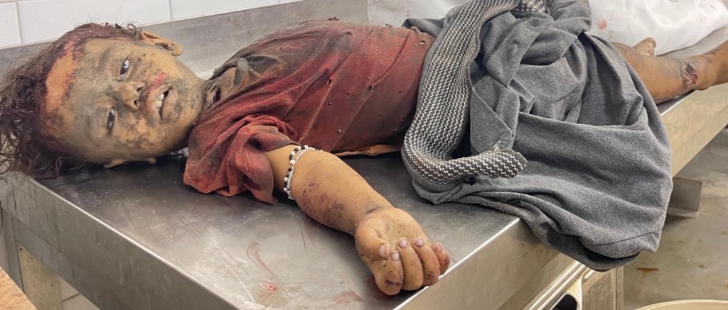 Six Children Killed in Israeli Bombing West Gaza City