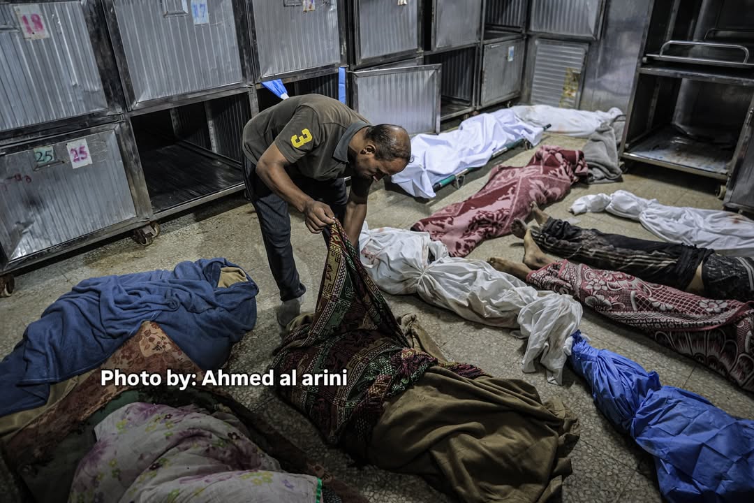 Palestinian casualties from Israeli airstrikes taken to Gaza hospital