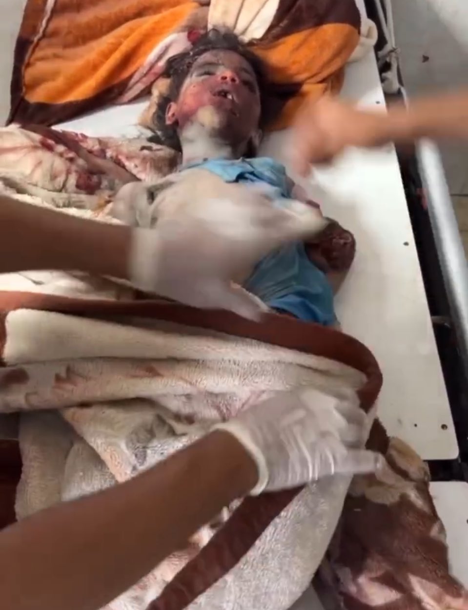 Israeli Forces Kill Palestinian Child in Rafah