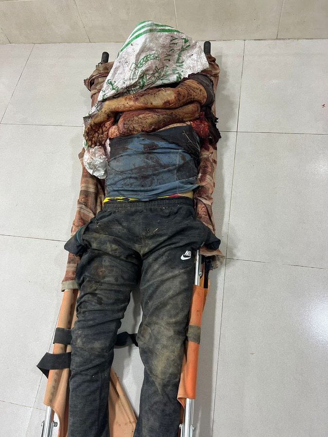 Death toll from Israeli attacks at aid distribution point rises to 17