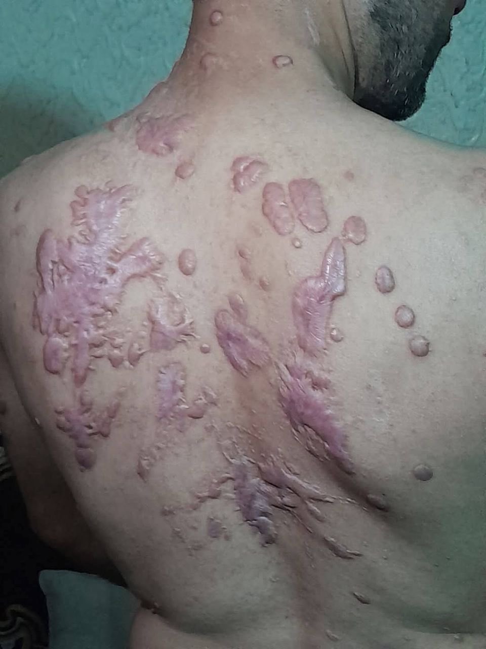 Palestinian Detainee Released After Torture Allegations