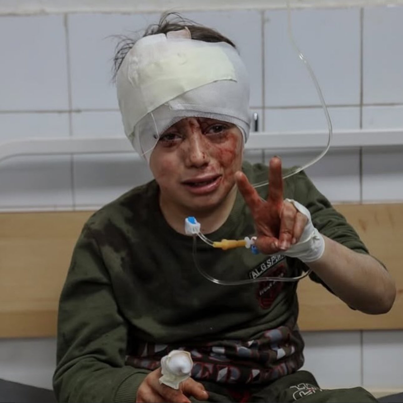 Child injured in Israeli air strike in Gaza City