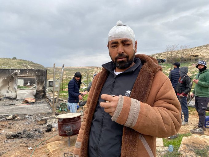 Palestinian Man Resilience After Settler Attack and Property Destruction