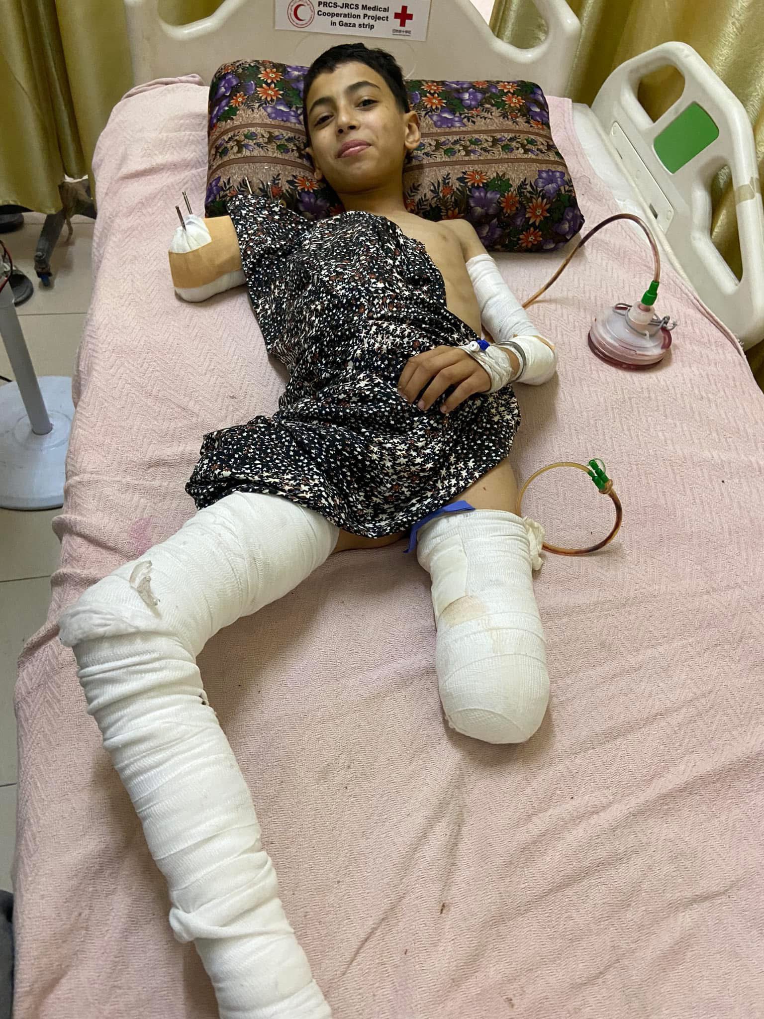Palestinian child Samir injured in Israeli airstrike on family home