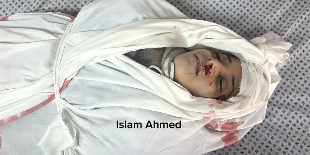 10-year-old killed in Israeli strike near Gaza hospital