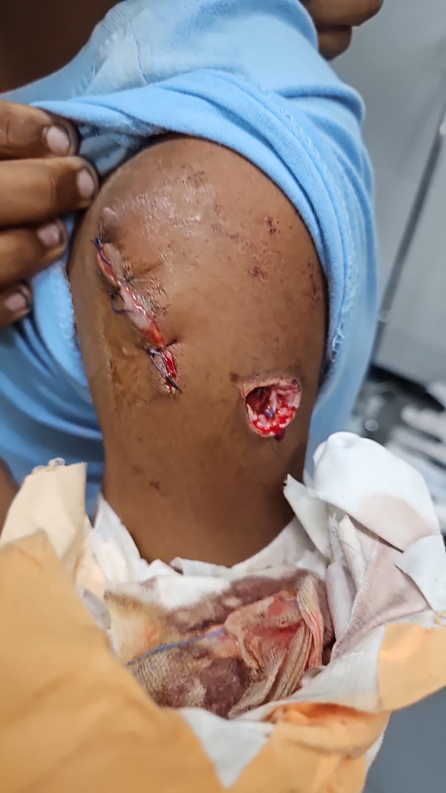 Child in Gaza situation raises concern