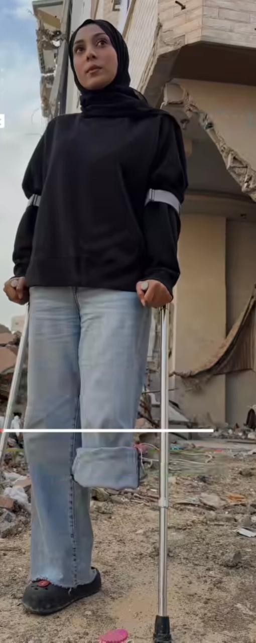 Amputee Runner Rozan Khaira Perseveres Despite Physical Loss