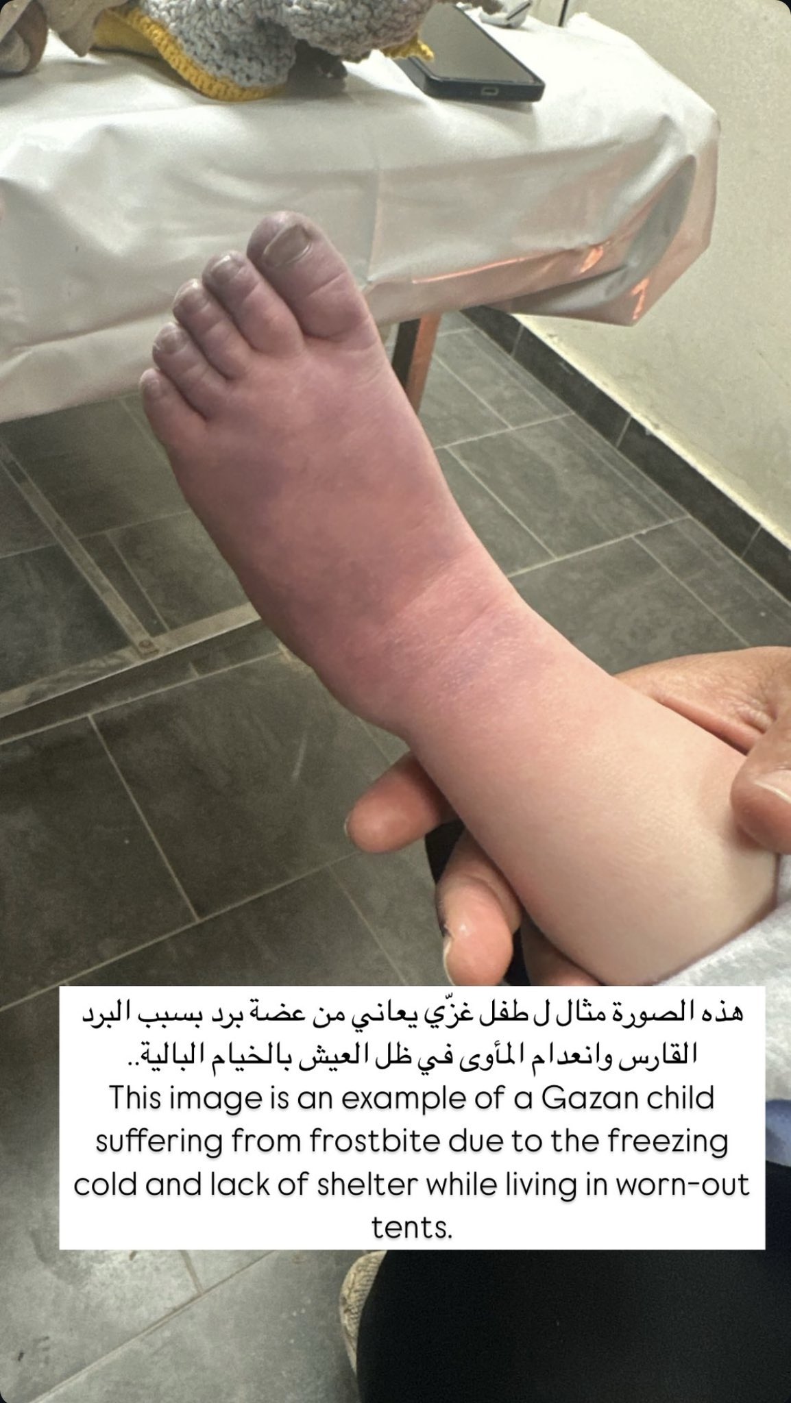 Gaza Children’s Suffering and Global Response