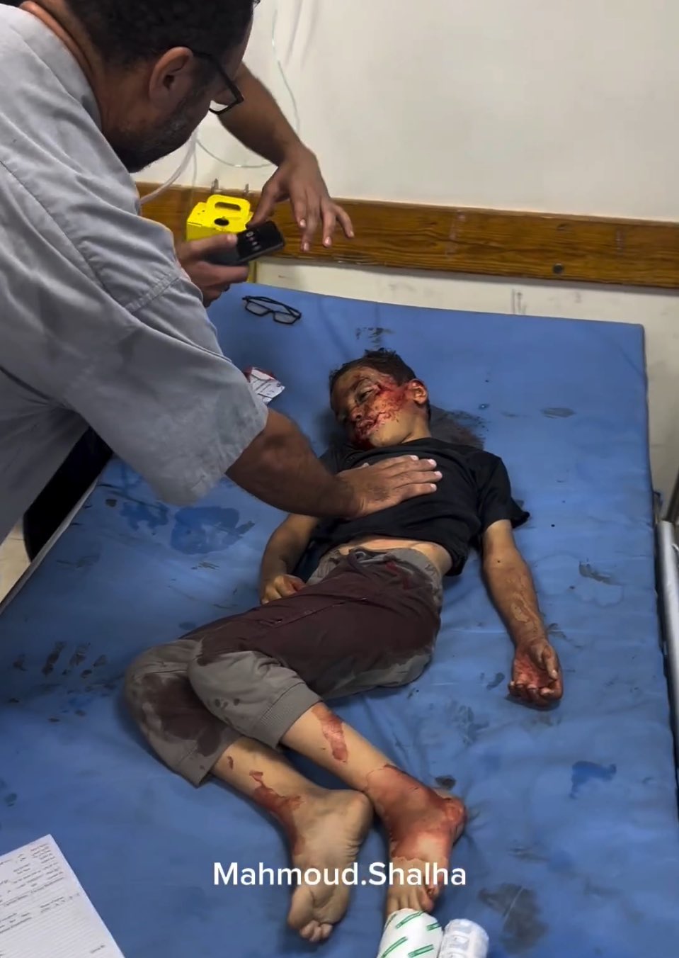 Palestinian Child Dies From Lack Medical Facilities Hospital