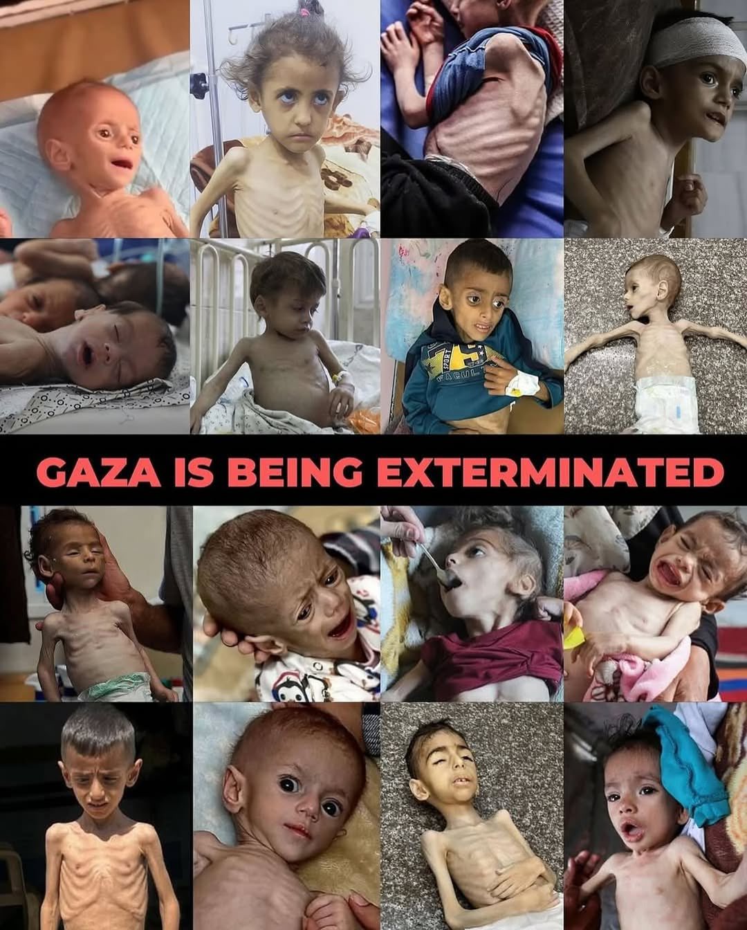 Children in Gaza Dying from Hunger Crisis