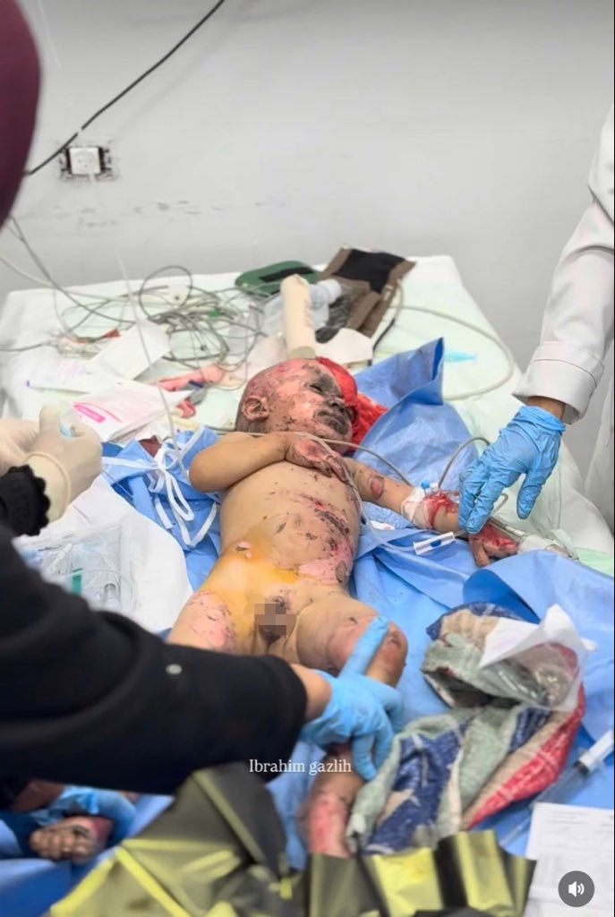 Israeli Military Operations in Gaza: Casualty Report