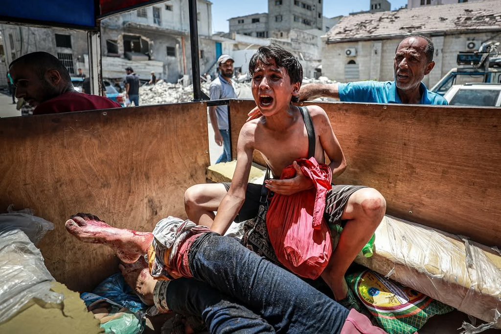 Gaza casualty report: 104 killed, 399 wounded in 24 hours