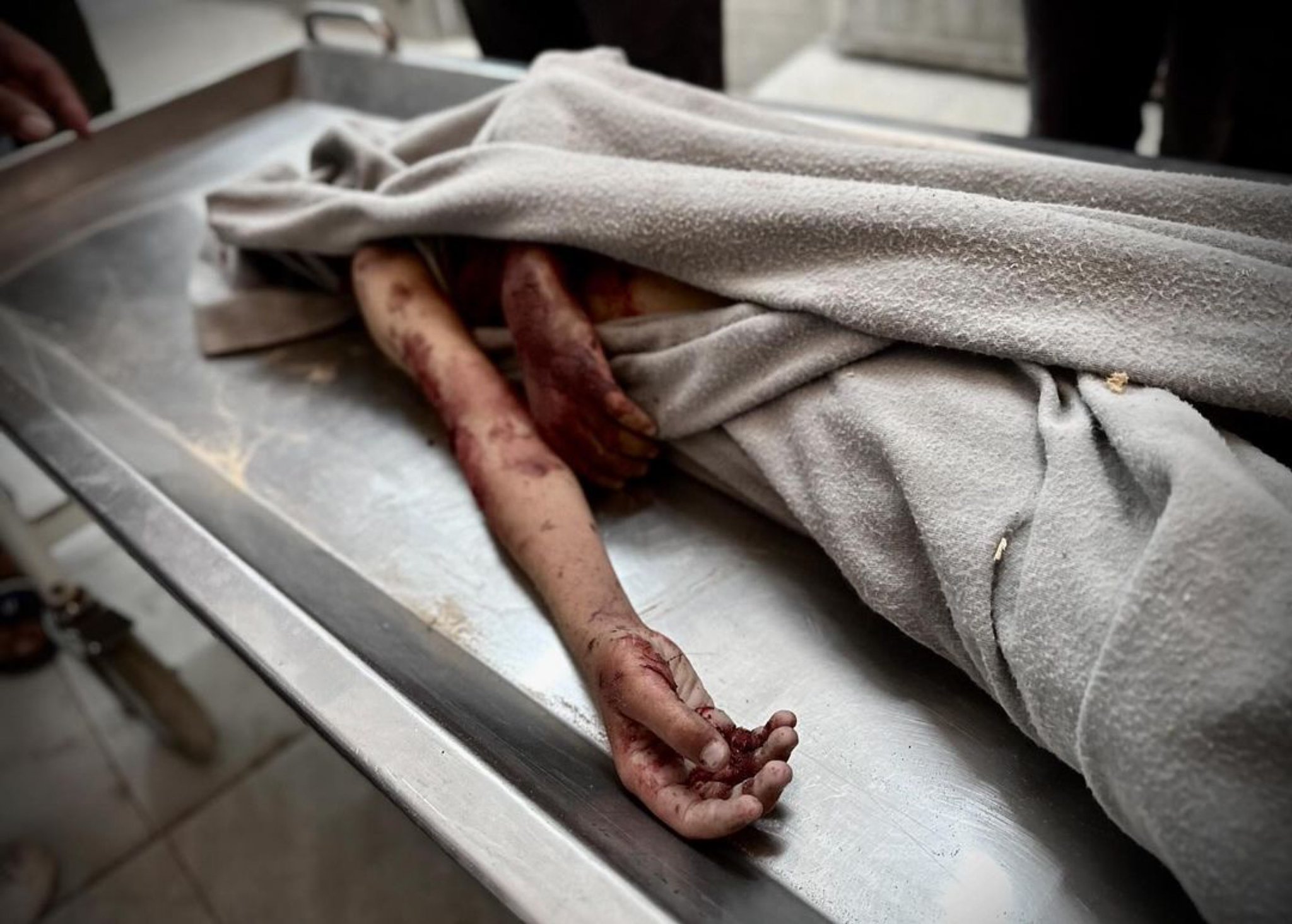 37 Palestinian Civilians Killed in Israeli Gaza Attacks