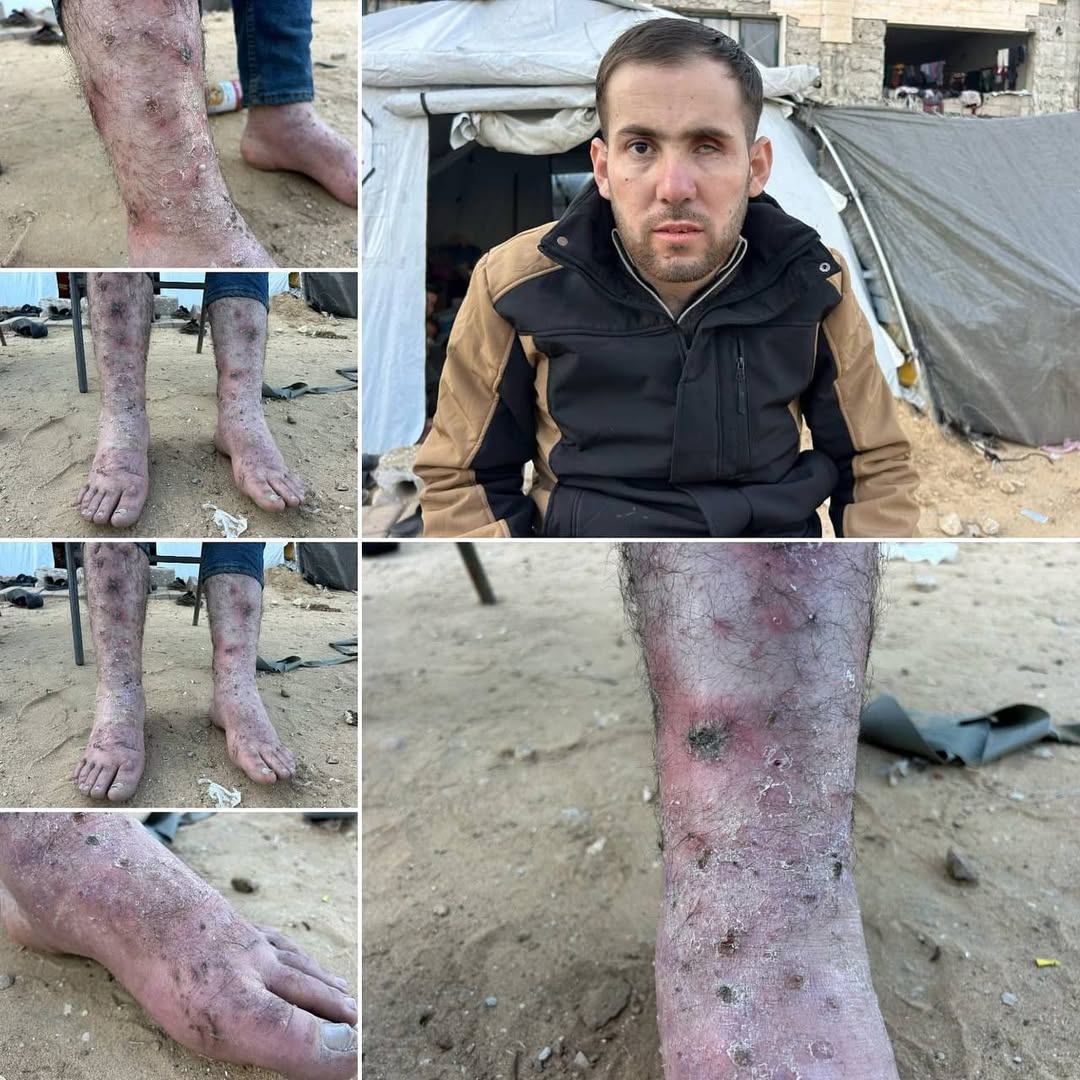 Torture marks found on released Gaza prisoner from exchange deal
