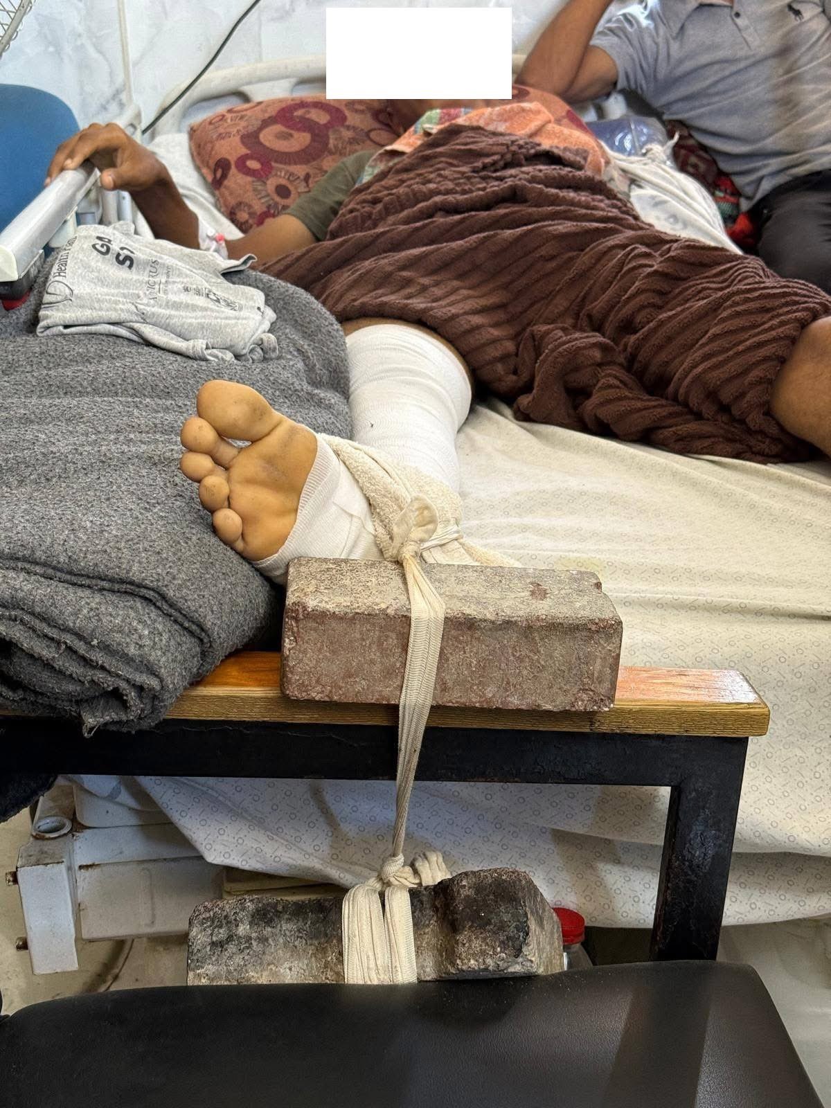 Israeli Genocide: Gaza’s Health System Collapse Forces Improvised Medical Care