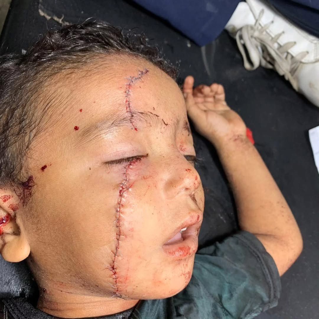 Israeli forces accused of harming Gaza baby with US support