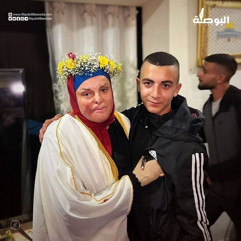 Injured Palestinian detainee Israa Ja’abis reunited with son