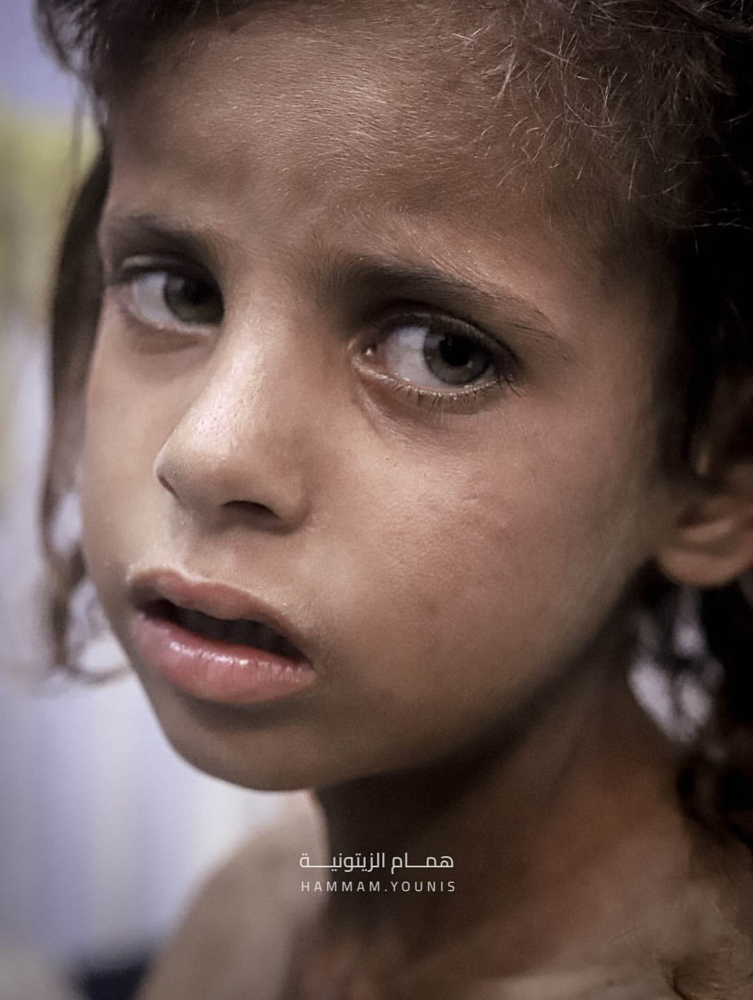 Mai starving in Gaza humanitarian crisis