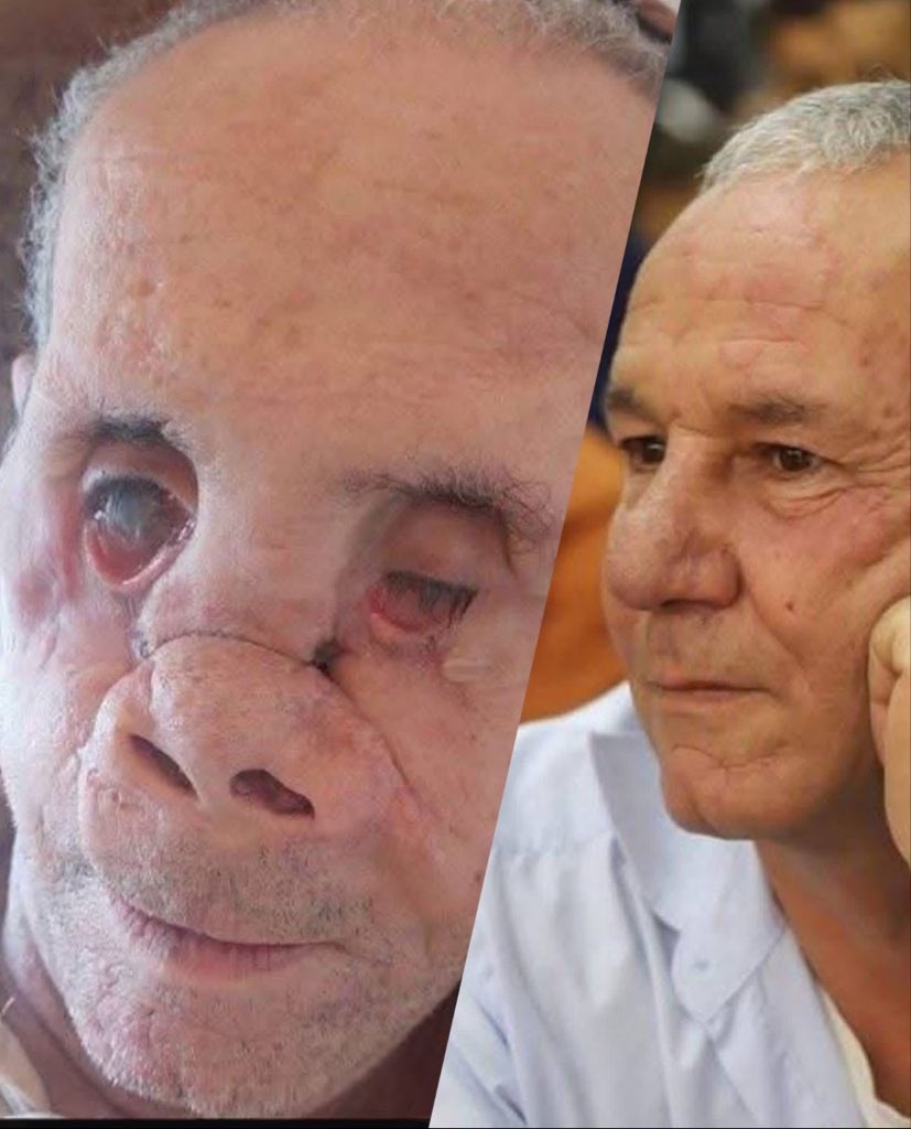 Before and after: Israeli bombing kills 17 family members