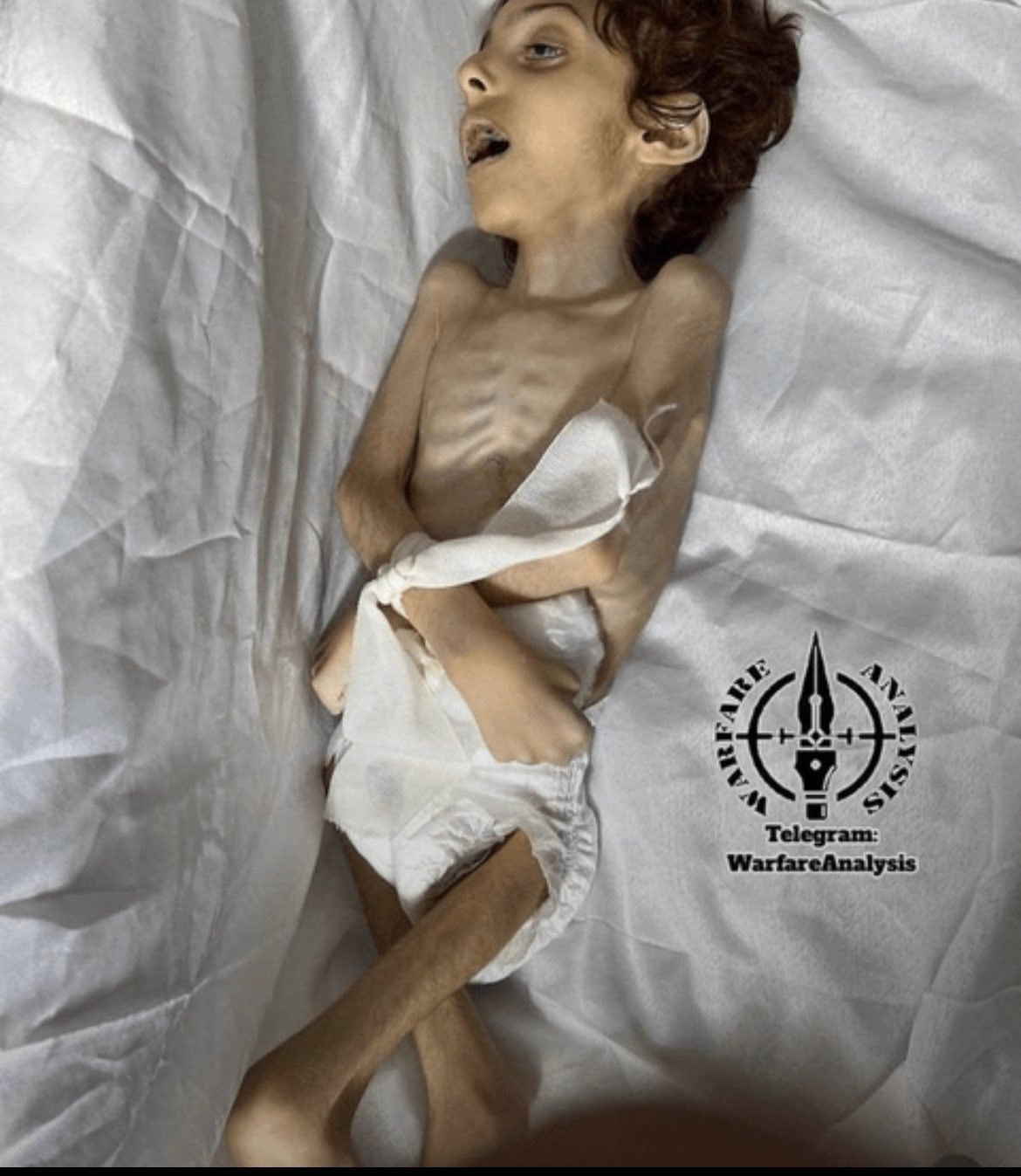 Intentional Starvation in Gaza: Official Statement