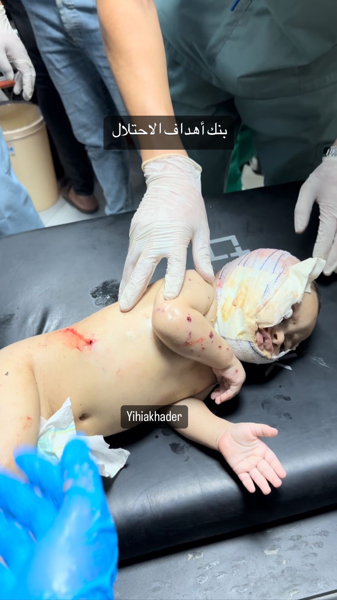 Israeli Occupation Forces Targets Over Ten Months